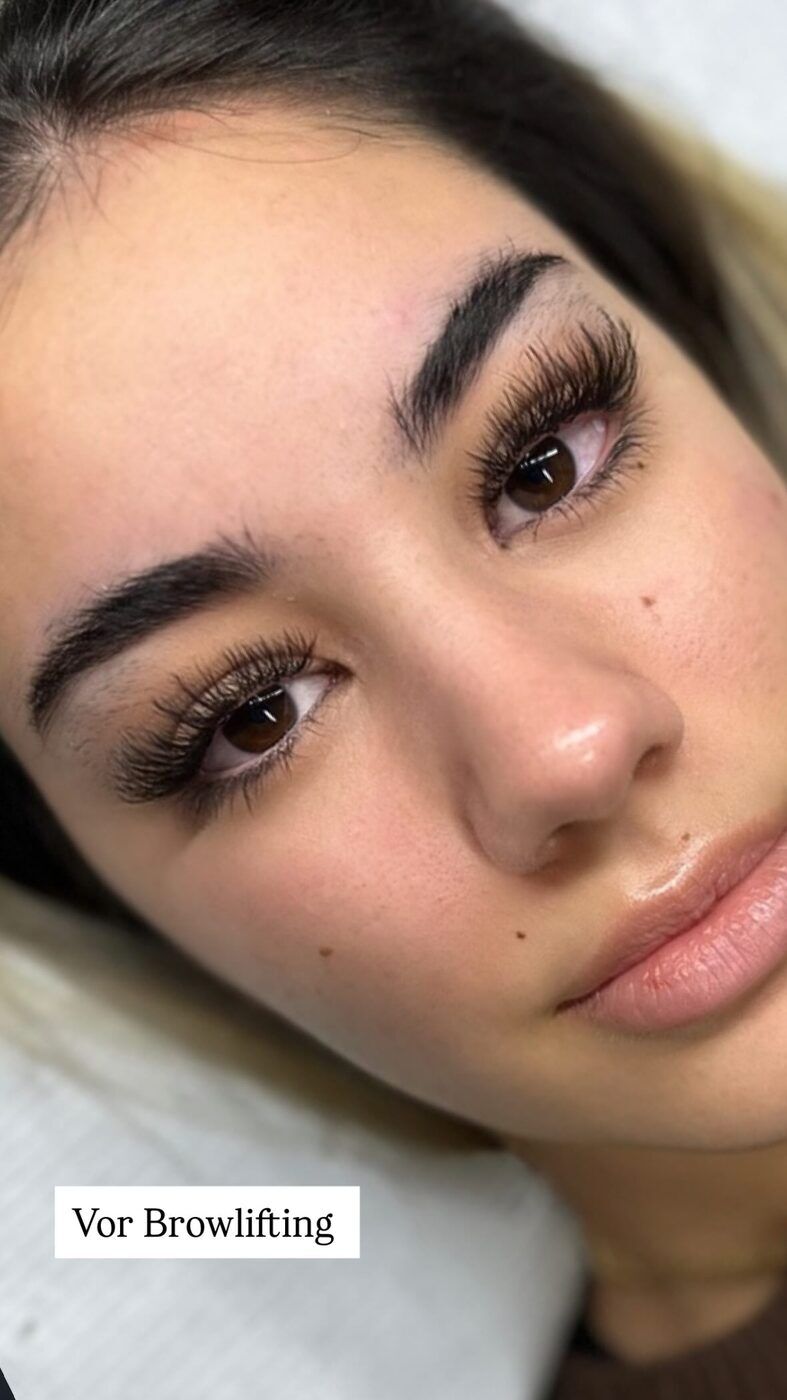 Browlifting – vorher